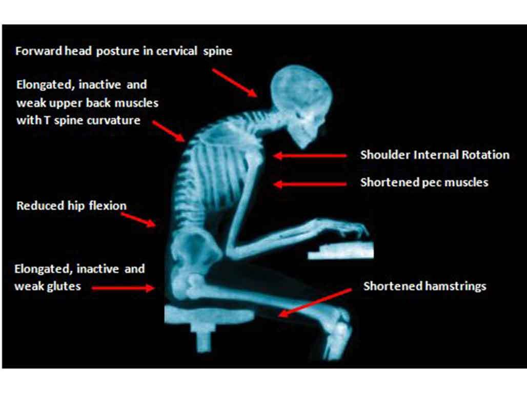 Office posture 2