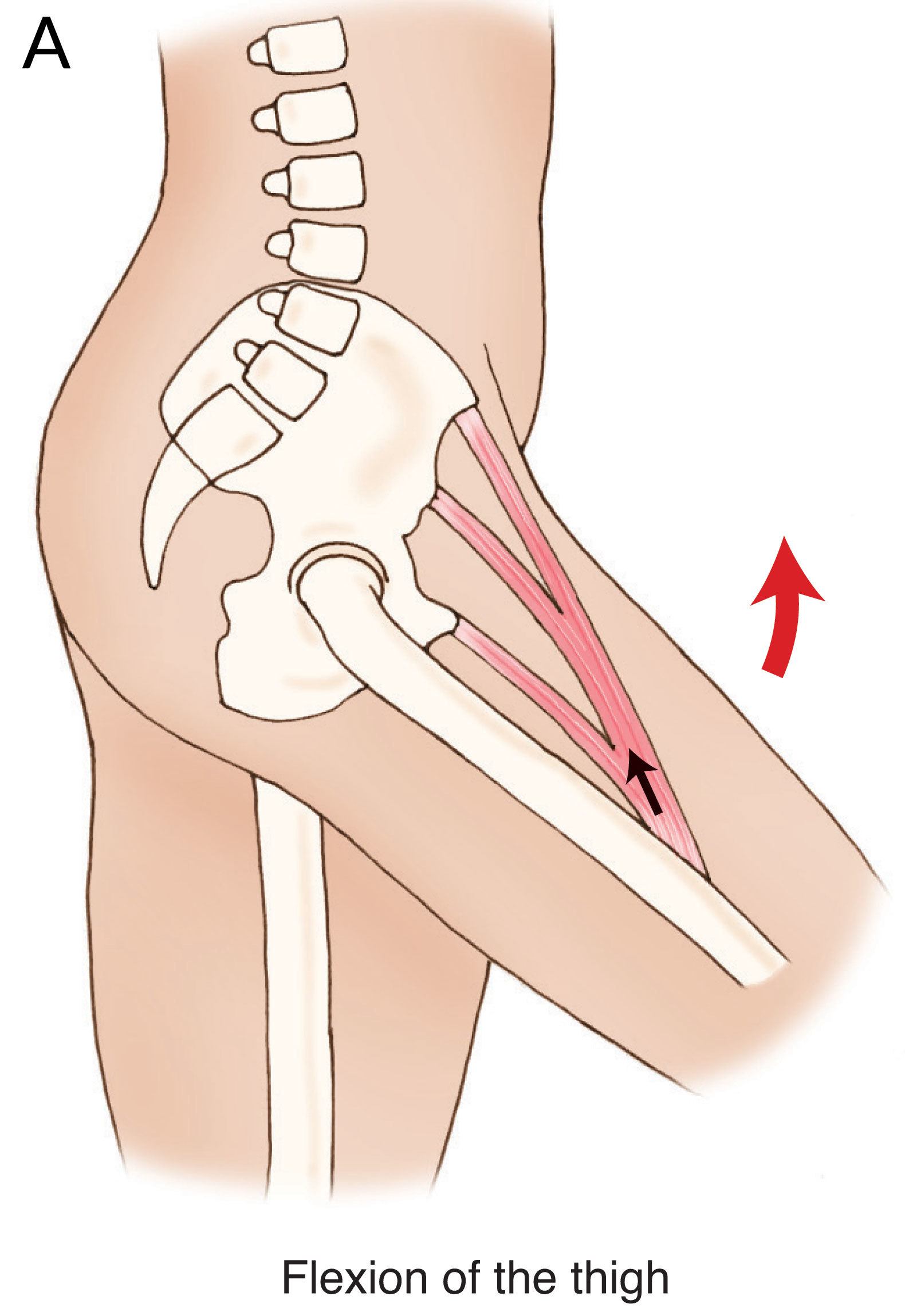 Psoas-Blog-Figure-5A