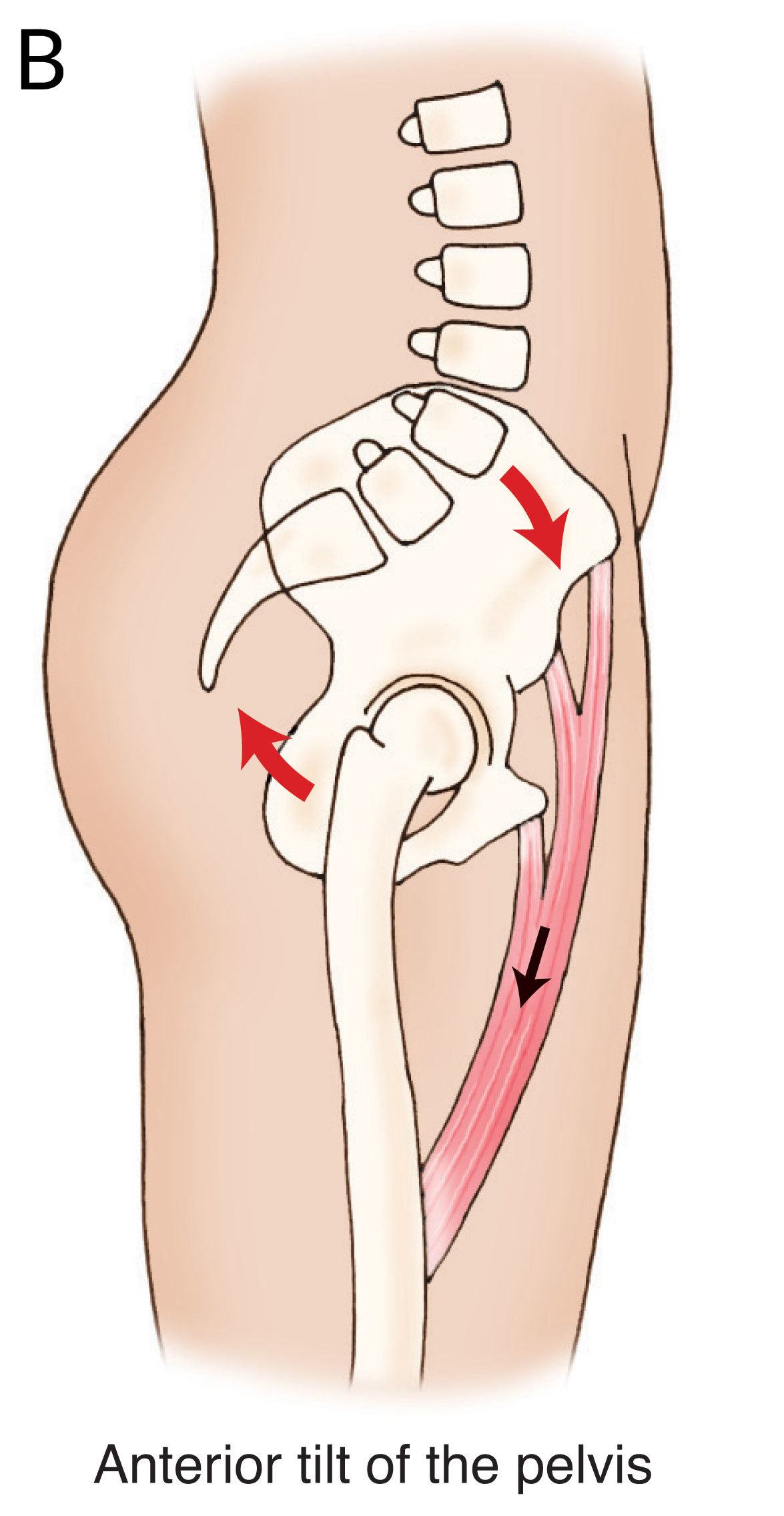 Psoas-Blog-Figure-5b
