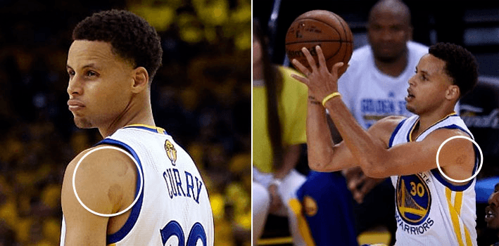 curry cupping curry cupping