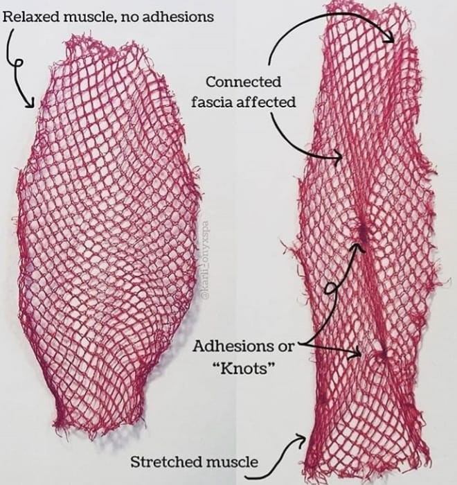 knots and fascia knots and fascia