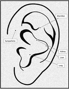 Acupuncture Specialists Acupuncture Specialists for Anxiety