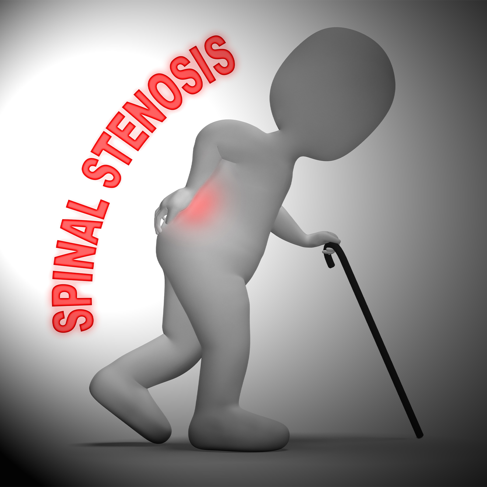 Spinal Stenosis_1