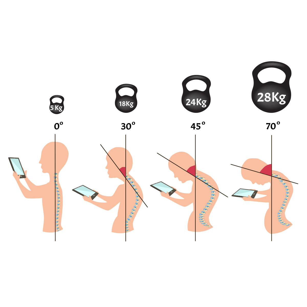 Improper posture Improper posture